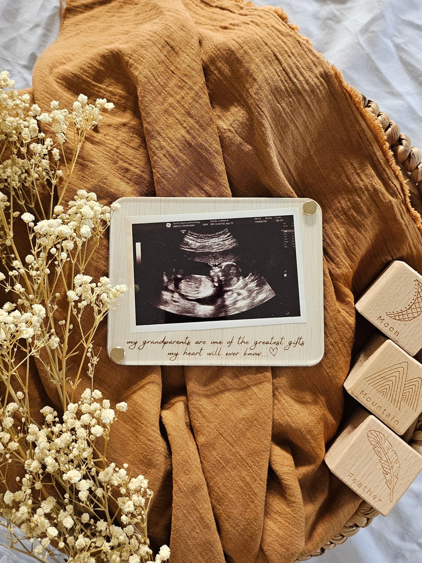 ULTRASOUND PHOTO DISPLAY PLAQUE